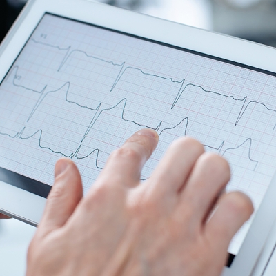 Eletrocardiograma Computadorizado (ECG)